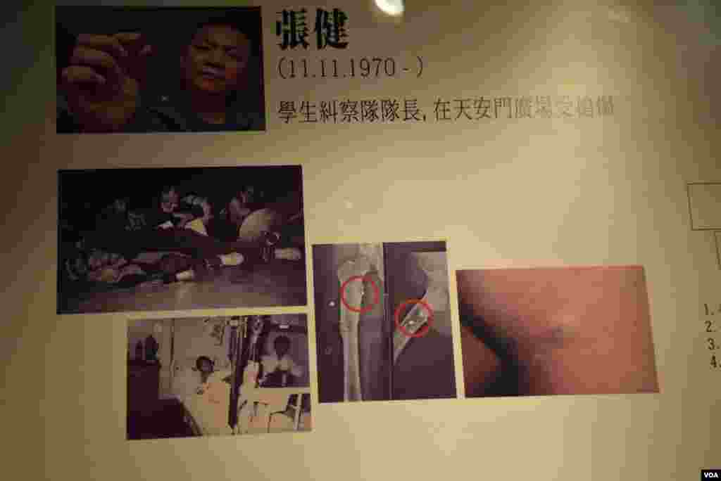 1989年6月4日凌晨學生糾察長張健,在天安門廣場東觀禮台對面的天安門廣場,被軍官連射3槍,其中一顆子彈留在體內19年。(美國之音湯惠芸拍攝)