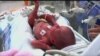 An international team of researchers has identified -- for the first time -- six genes that determine the length of pregnancy and whether a baby is born preterm. Preterm birth is a major cause of infant death and disability. Now scientists may have clues about preventing prematurity.